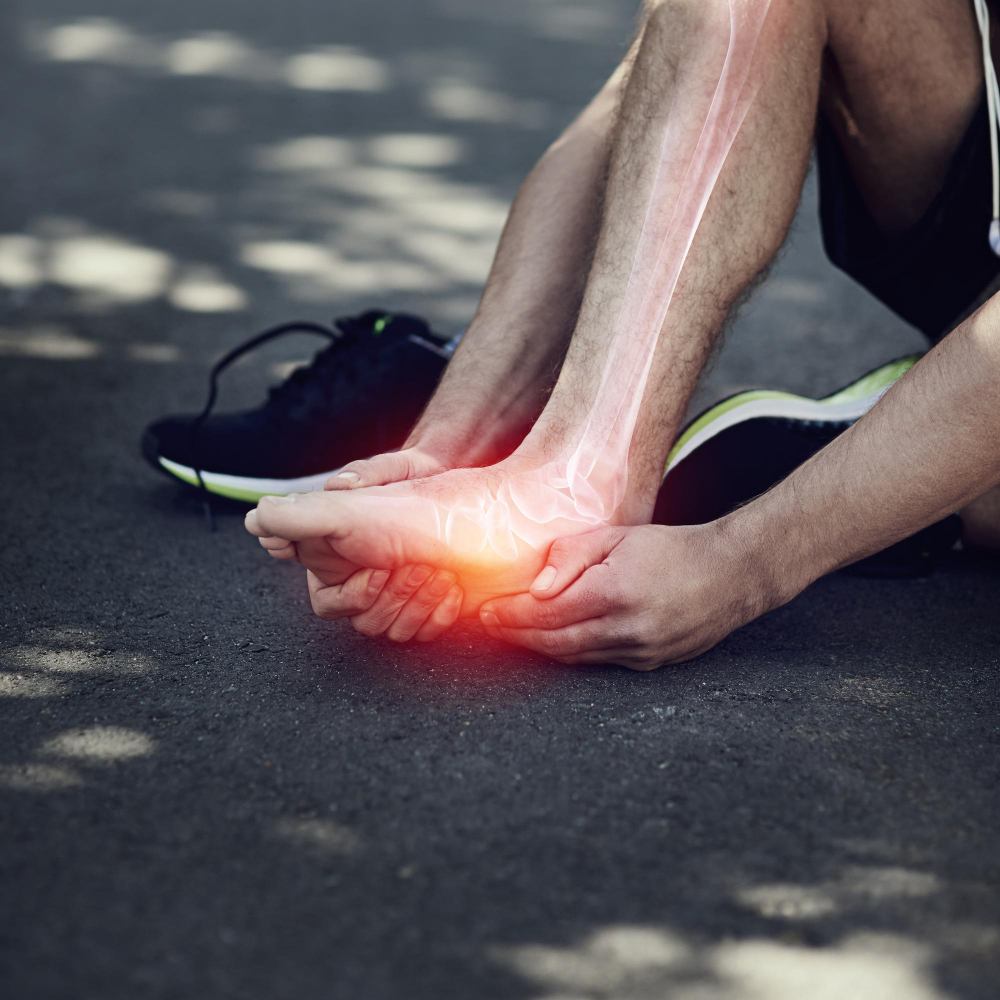 Plantar fasciitis - Symptoms and causes - Mayo Clinic