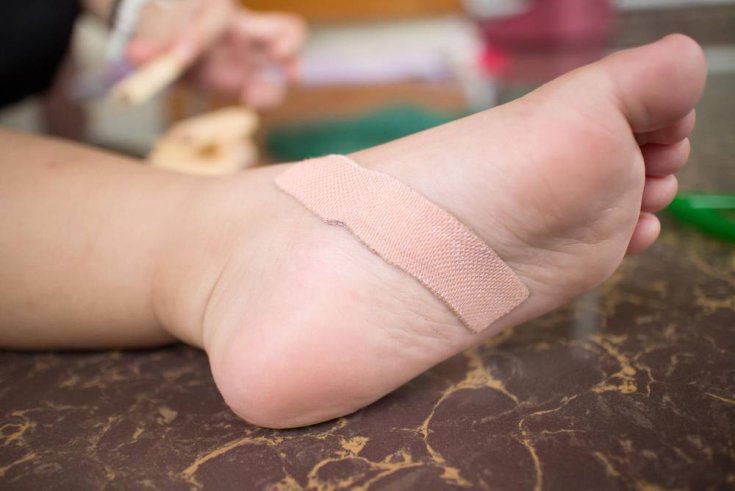Scar Management of Foot Wounds